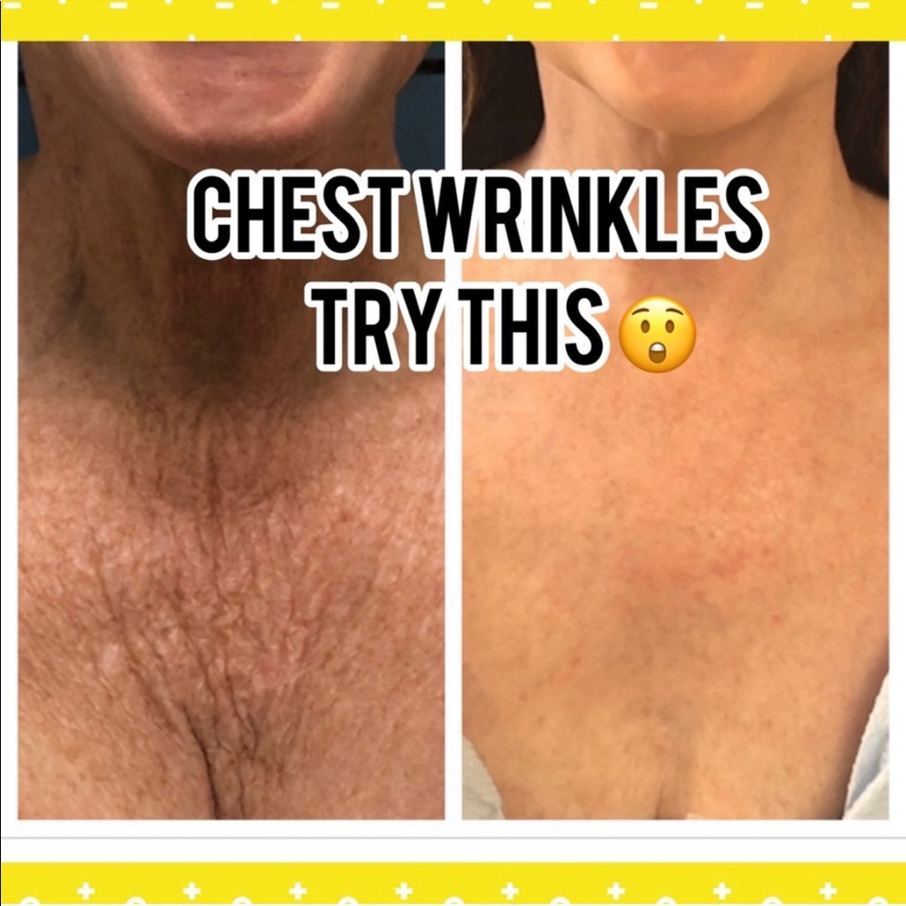 Wrinkle release